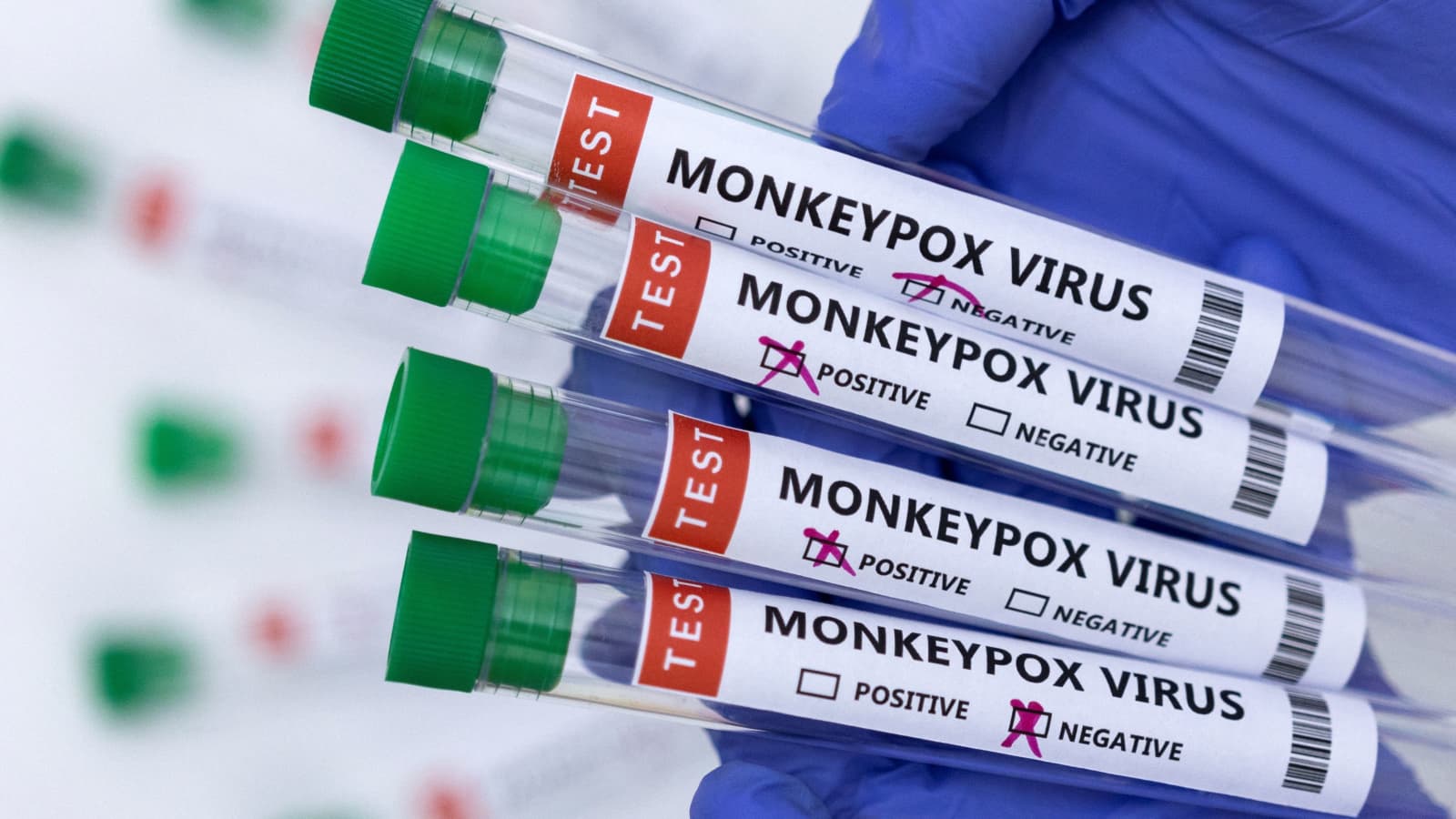 WHO vows nothing ridiculous as public submits ideas to rename monkeypox   