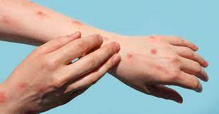 Top Chinese epidemiologist asks citizens not to touch foreigners to avoid monkeypox, faces backlash   
