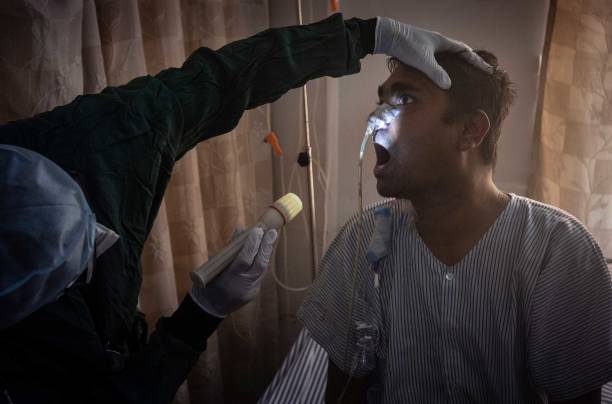 Bihar govt declares black fungus infection an epidemic